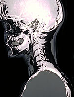 Una foto de una radiografía de la cabeza