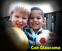 Fotografía simulada de la glaucoma