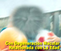 Fotografía simulada de la degeneración macular relacionada con la edad