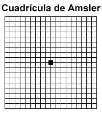 La gráfica estilo tabla de Amsler