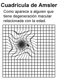 La gráfica estilo tabla de Amsler como se la ve alguien que tiene degeneración macular relacionada con la edad