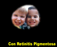 Fotografía simulada de la renitos pigmentosa