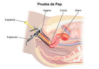Ilustración de un método de prueba de pap