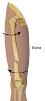 Dibujo de la fractura espiral