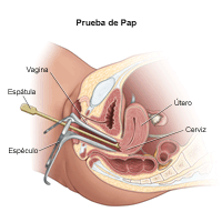 Ilustración de un método de prueba de pap