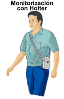 Dibujo de un hombre que lleva un monitor tipo Holter