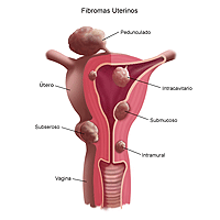 Ilustración de fibras uterinas