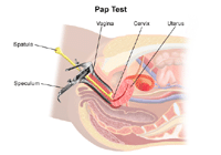 Illustration of a pap test procedure
