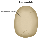 Illustration of a newborn
