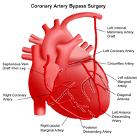 Anatomy of the heart following coronary artery bypass surgery