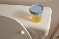 Picture of urine specimen on toilet tank