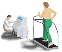 Illustration demonstrating an exercise EKG
