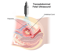 Illustration of transabdominal fetal ultrasound