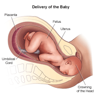 Illustration of the delivery of the baby