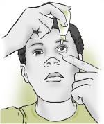 To put eyedrops in the eye, pull down the lower lid and look up