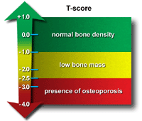 Illustration of T-score and what it means 