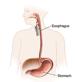 Outline of woman showing mouth, esophagus, and stomach.