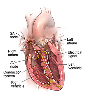 Front view crosss section of heart showing normal conduction system.