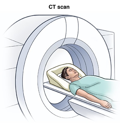 Male lying on back on CT scanner table is about to move into circular opening of CT scanner.