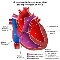 Anatomía de un corazón con una comunicación interauricular