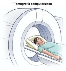 Tomographfia computerizada