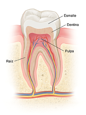 Corte de sección de un diente que muestra esmalte, pulpa, canal radicular, encía y hueso. 