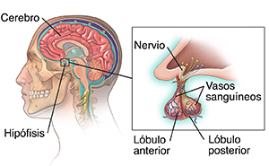 Vista lateral de una cabeza y un cuello con corte transversal del cerebro donde se observa la hipófisis. En el recuadro, se muestra un primer plano de la hipófisis.